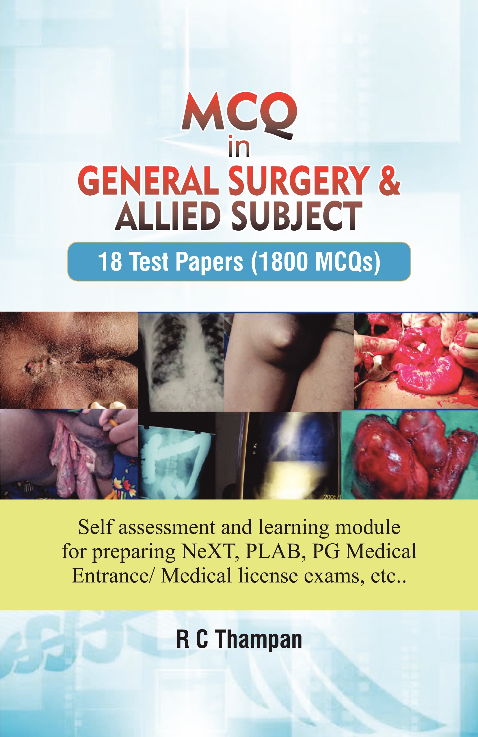 MCQ IN GENERAL SURGERY AND ALLIED SUBJECTS -18 test papers (1800 MCQs ...