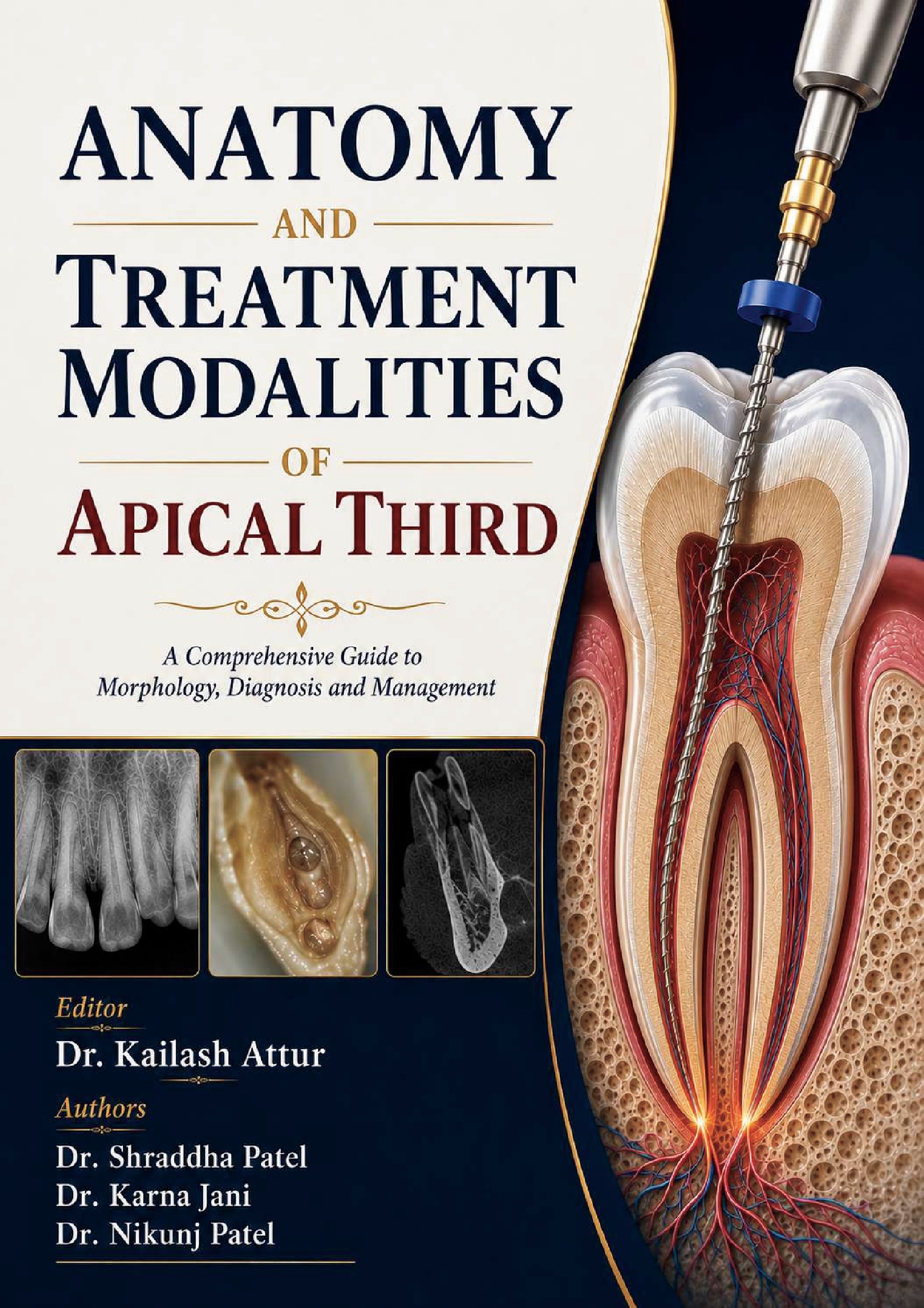 ANATOMY AND TREATMENT MODALITIES OF APICAL THIRD | Pothi.com